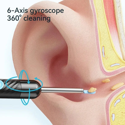 Clearyn™ — Nettoyeur d'oreilles avec caméra HD